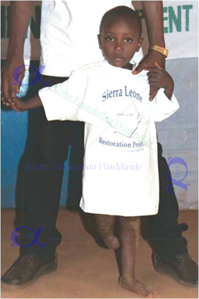 Amputee camp relief donation